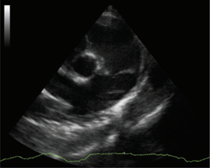 fig 5b