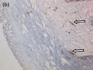Fig 8b