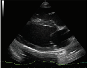 fig 5a