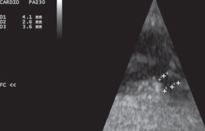 figure 1b