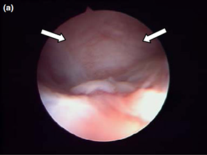 Fig 5a