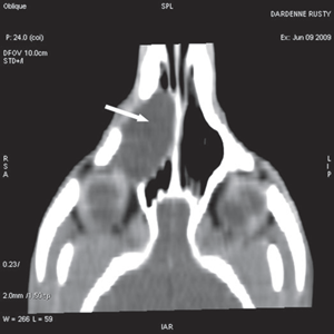 Fig 3c