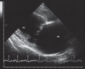 Fig 7 Echo 4