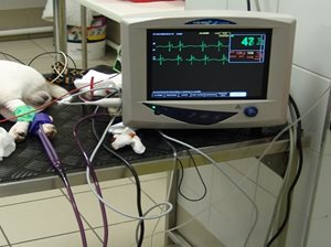 moniteur cardiaque