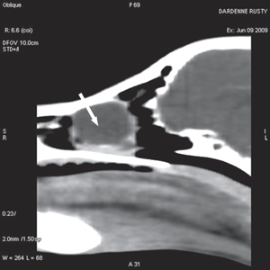 Fig 3b