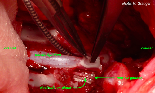 implantation electrodes