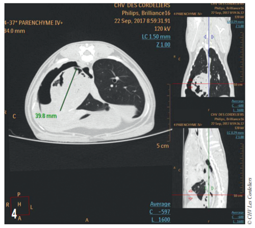 Fig 4