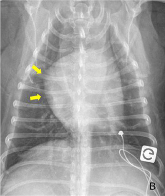 figure 1b