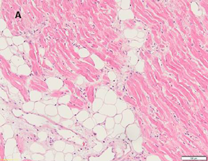 fig 4a