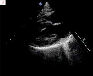 Image échocardiographique de contrôle