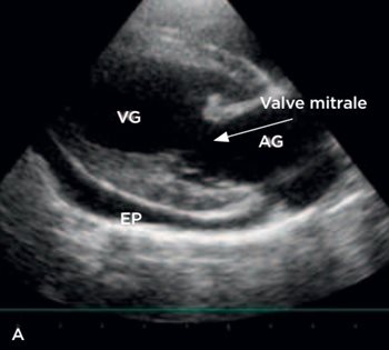 Figure 1a