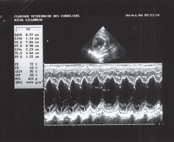 Fig 6 Echo 3